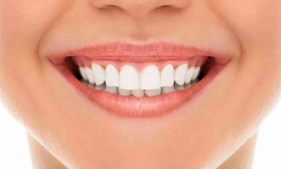 Bọc răng sứ không mài răng có được không? Ai nên làm phương pháp này?