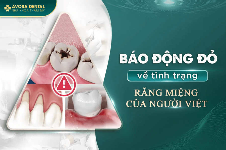Bảng Giá Dịch Vụ Nha Khoa Tổng Quát Tốt Nhất Tại TP.HCM