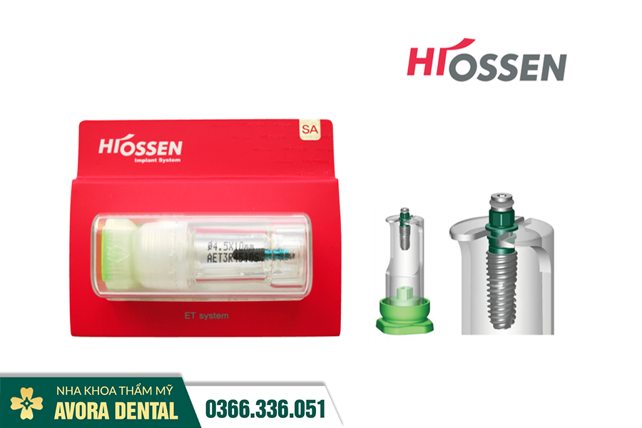 Trụ Implant Hiossen Có Tốt Không? Xuất Xứ Và Giá Cả Như Thế Nào?