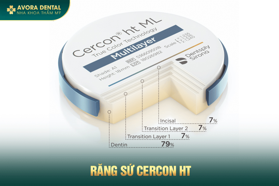 Răng Sứ Cercon HT Là Gì? Có Tốt Không? Chi Phí Mới Nhất 2025