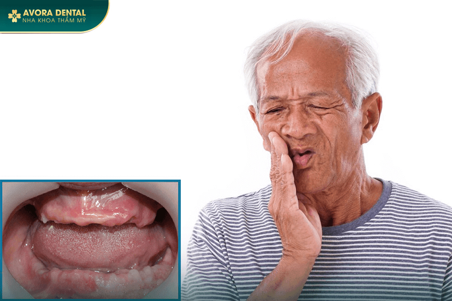 Trồng Răng Implant Cho Người Già Có Được Không? Chi Phí Bao Nhiêu?