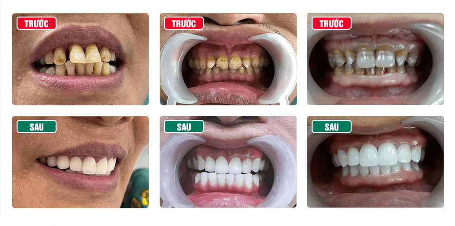 Nha Khoa AVORA Dental