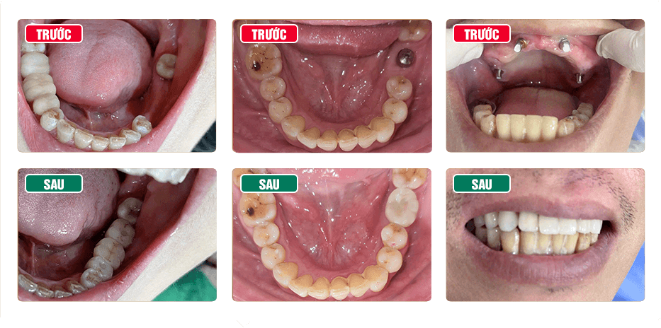 Nha Khoa AVORA Dental