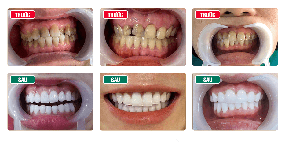 Nha Khoa AVORA Dental