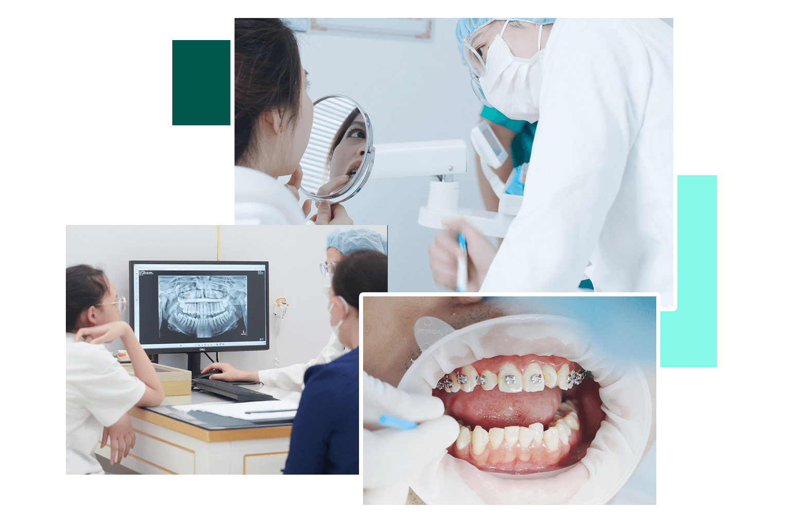 Nha Khoa AVORA Dental